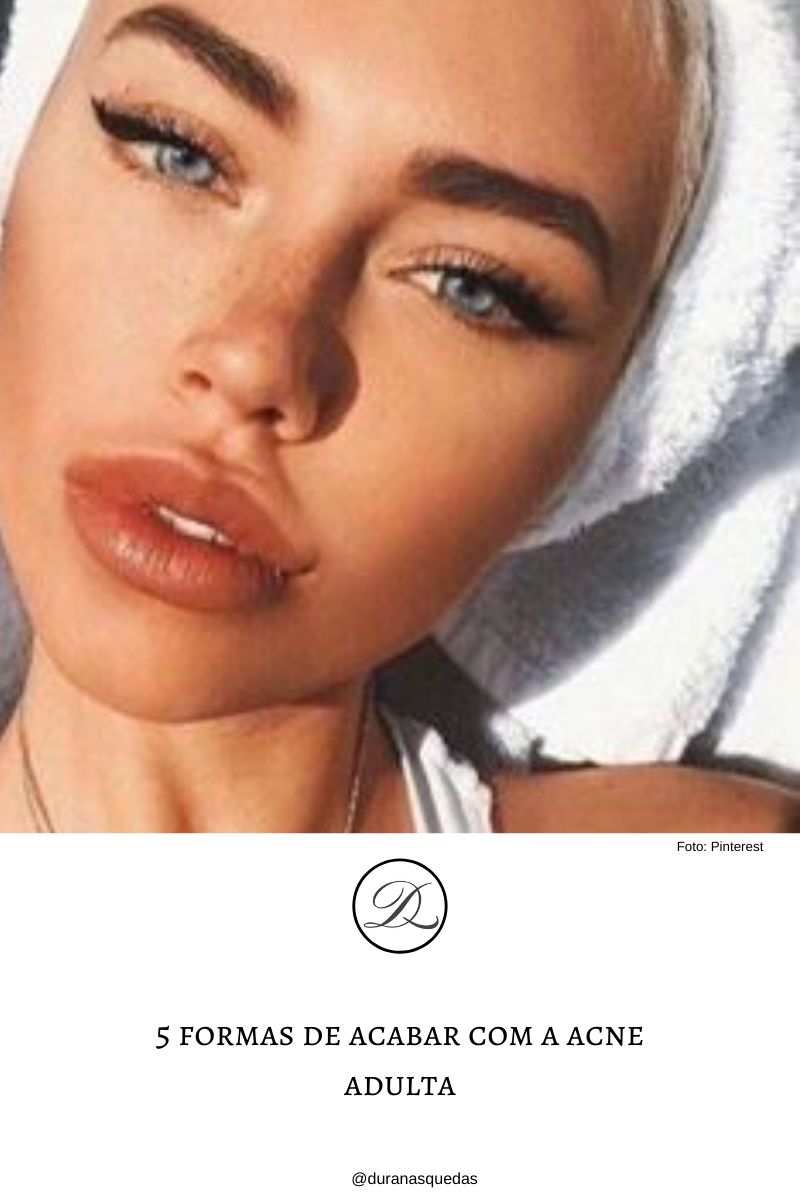 5 formas de acabar com a acne adulta
